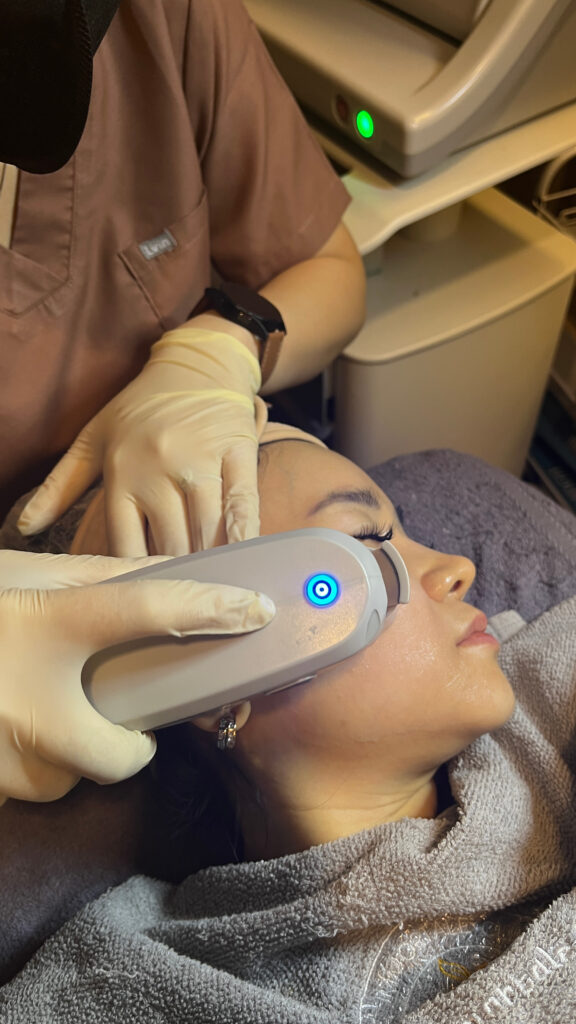 Treatment HIFU di Le' Immortale Clinic