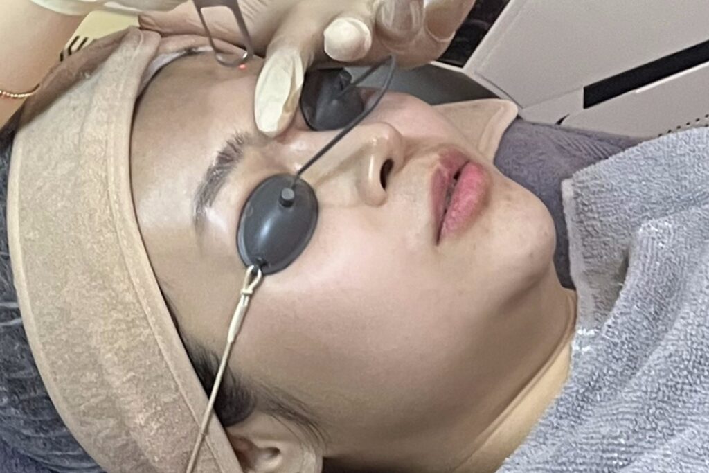 dr. Mariska Natalia melakukan tindakan laser pada wajah pasien di Le' Immortale Clinic