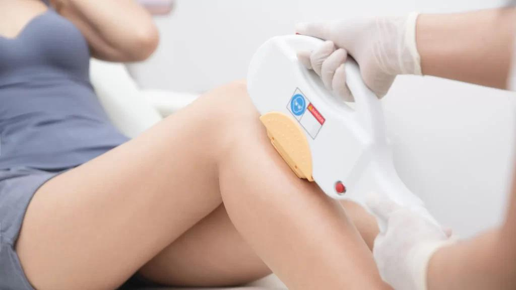 Treatment i2PL hair removal di kaki pasien menggunakan mesin laser di Le' Immortale Clinic